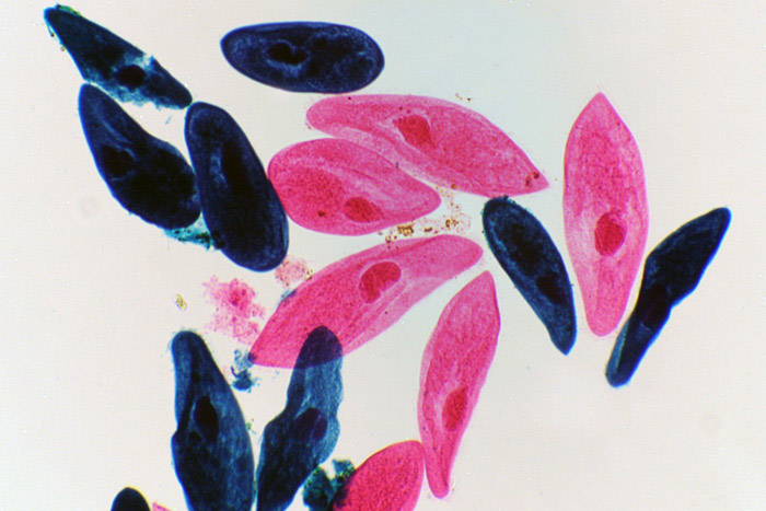 инфузории под микроскопом, инфузория микроскоп, инфузория туфелька микроскоп, инфузория туфелька под микроскопом