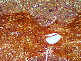 мозг под микроскопом, мозги под микроскопом, мозг под микроскопом фото, мозг человека под микроскопом, мозг человека под микроскопом фото