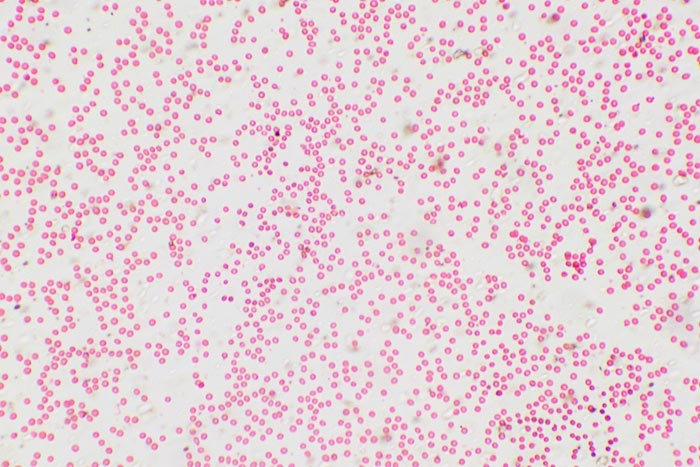 кровь под микроскопом, кровь под микроскопом фото, кровь человека микроскоп