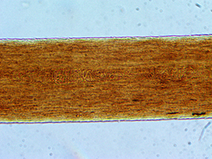 волос под микроскопом, волос под микроскопом фото, как выглядят волосы под микроскопом, перекрест волос под микроскопом, человеческий волос под микроскопом