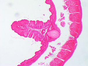 червяк под микроскопом, червь под микроскопом, дождевой червь под микроскопом, червь под микроскопом фото, червяк под микроскопом фото, как выглядит червяк под микроскопом