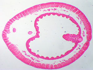 червяк под микроскопом, червь под микроскопом, дождевой червь под микроскопом, червь под микроскопом фото, червяк под микроскопом фото, как выглядит червяк под микроскопом