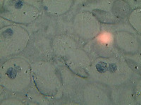 Митоз клеток яиц аскариды, увеличение 800х