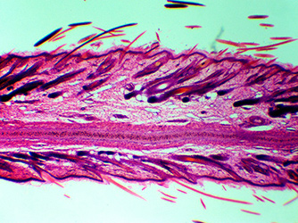 кожа микроскопом, кожа под микроскопом, кожа под микроскопом фото, кожа человека под микроскопом
