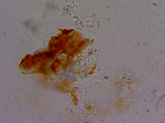 кристаллы под микроскопом, кристалл сахара под микроскопом, кристаллы серебра под микроскопом, кристаллы под микроскопом фото