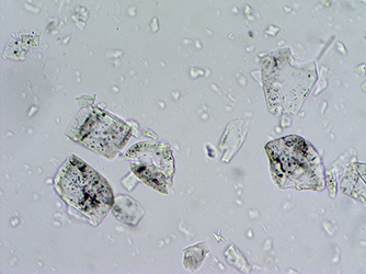 кристаллы под микроскопом, кристалл сахара под микроскопом, кристаллы серебра под микроскопом, кристаллы под микроскопом фото
